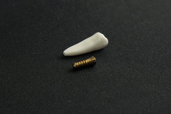 Quels sont les avantages des implants dentaires dans les centres dentaires ?